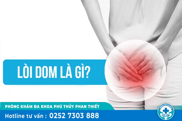 Lòi dom là gì? dấu hiệu nhận biết và cách chữa trị