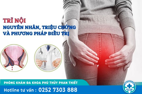 Những điều bạn cần biết về nguyên nhân triệu chứng và điều trị trĩ nội