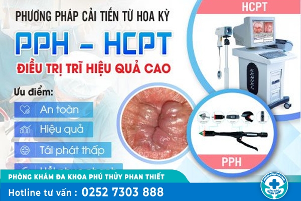 Tổng hợp các cách chữa trĩ hiệu quả hiện nay