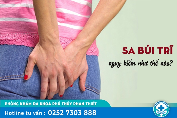 Triệu chứng sa búi trĩ và mức độ nguy hiểm cần cảnh giác