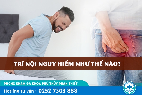 Trĩ nội nguy hiểm như thế nào? Điều trị ra sao?